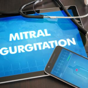 5 factors predict death in moderate/severe mitral regurgitation