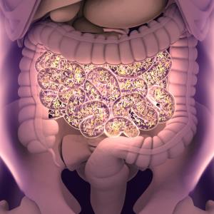 Colorectal cancer alters gut microbiome