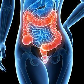 OPERA: CXB boost improves organ preservation in early rectal adenocarcinoma