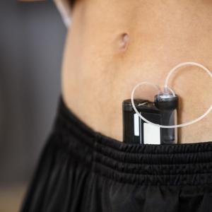 Continuous glucose sensors trump self-monitoring in type 1 diabetes