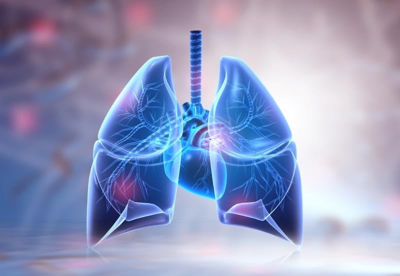 COPD tied to earlier lung cancer diagnosis