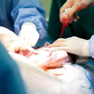 One vs two sets of busulfan TDM show similar outcomes in alloHCT