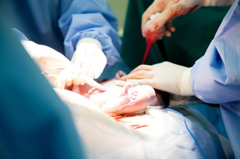 One vs two busulfan TDM sets show similar outcomes in myeloablative alloHCT