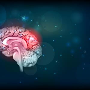 Lower phosphate levels tied to more severe stroke in young people