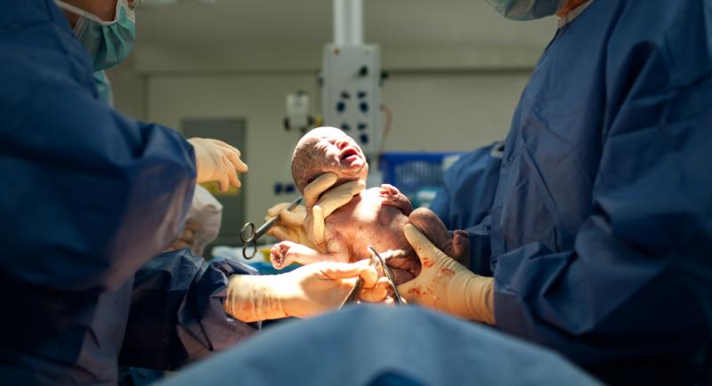 Crash Caesarean Section for Fetal Distress