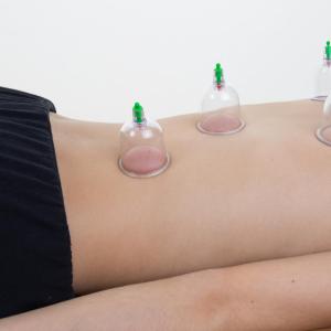 Cupping therapy offers relief from chronic pain