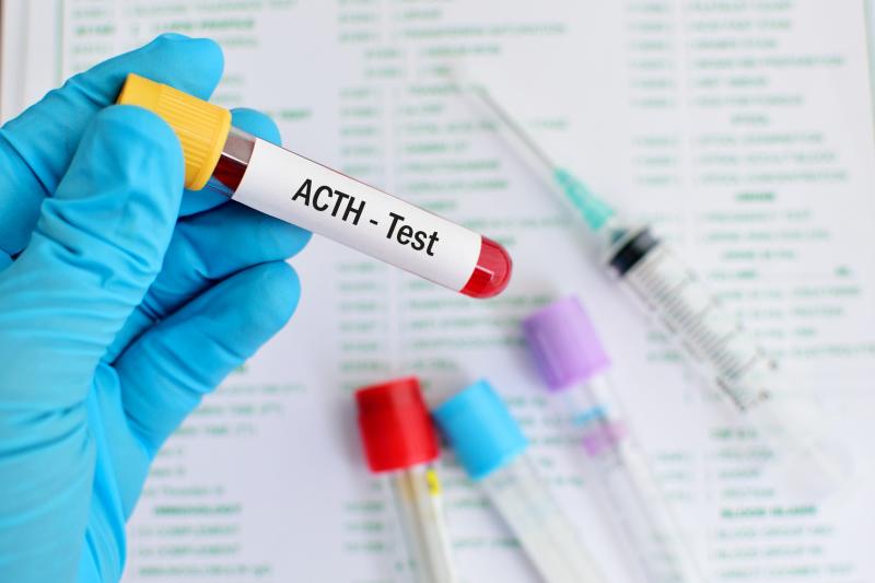 The first step in distinguishing the type of Cushing’s syndrome is a blood test for the measurement of ACTH obtained in the m