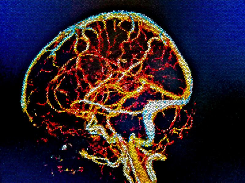 CVT risk higher after COVID-19 than COVID-19 mRNA vaccine