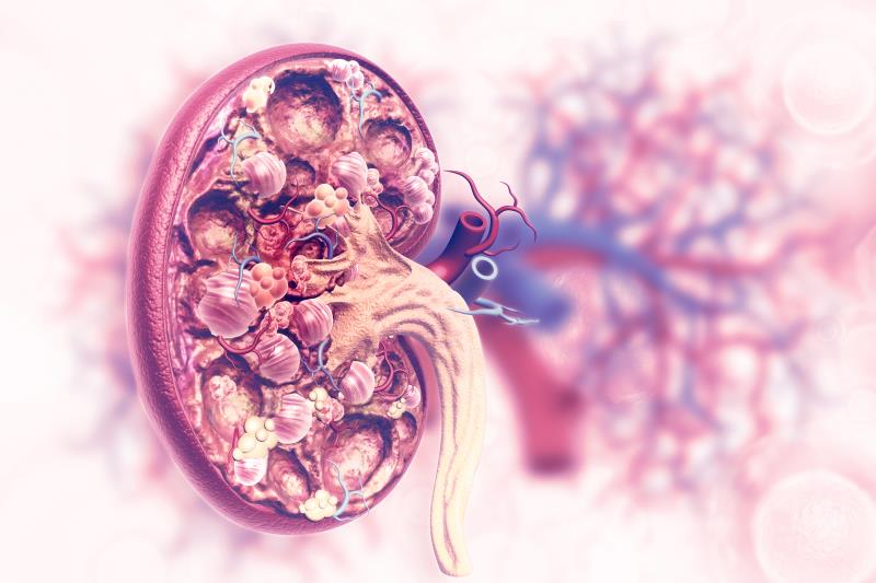 Connective tissue diseases increase complication risk after PCI