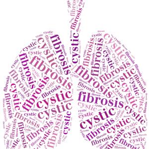 SLPI deficiency in cystic fibrosis much worse in P aeruginosa-infected female patients