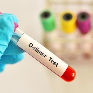 D-dimer predicts clinical outcomes in N. meningitidis infections