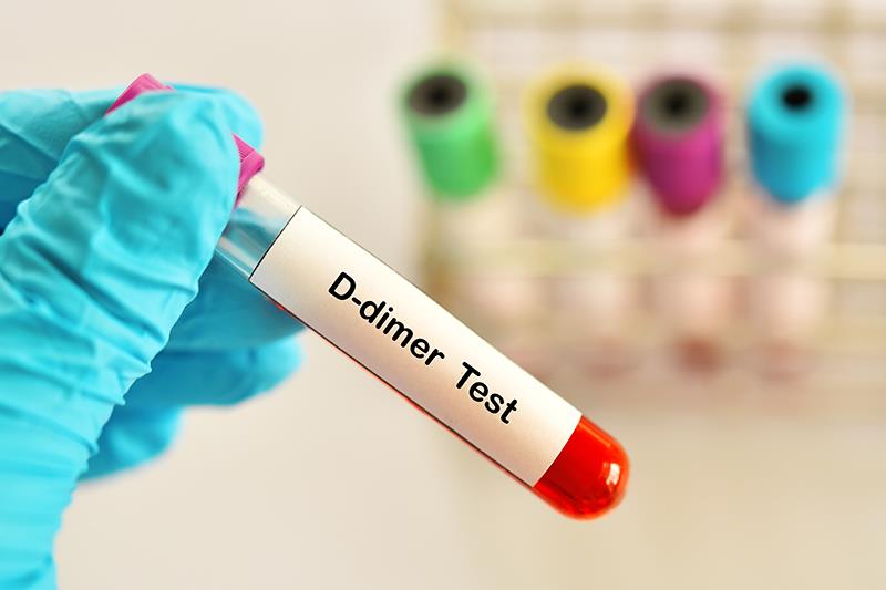 D-dimer predicts clinical outcomes in N. meningitidis infections
