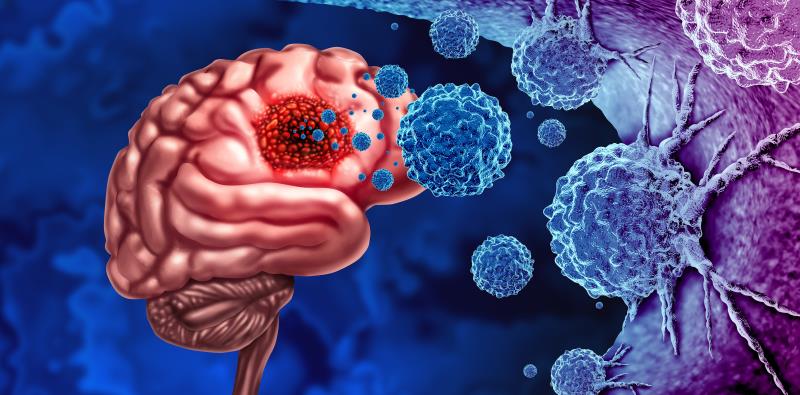 Hormone therapy poses no glioma risk