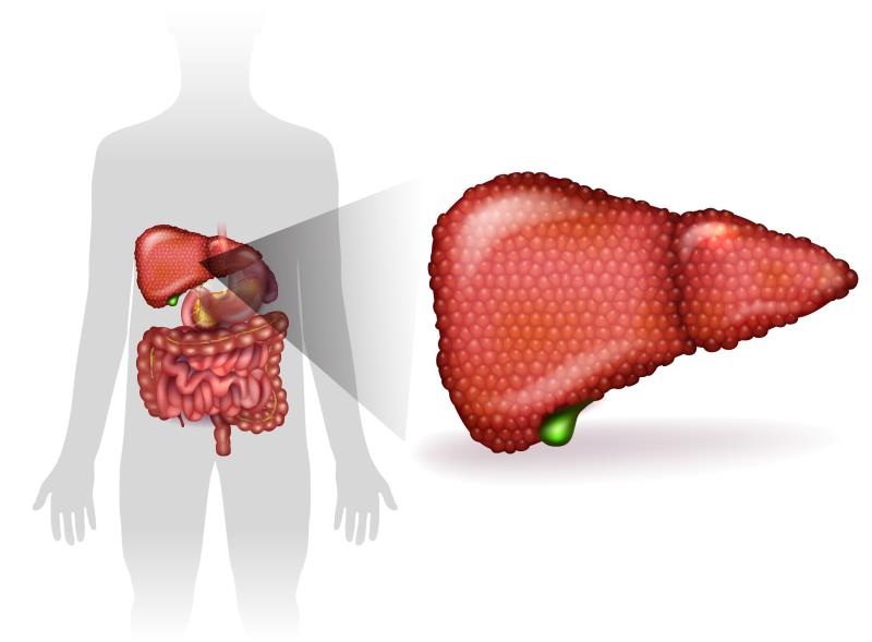 Daily albumin infusion fails to reduce infection, renal dysfunction in decompensated cirrhosis