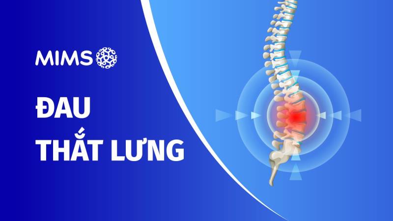 [Infographic] Dân văn phòng và những chiếc “cột sống” không bao giờ ổn – Dược sĩ nên tư vấn thế nào đây?