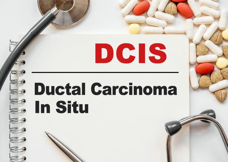 DCIS in HK: Increased mortality rate despite excellent long-term survival