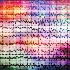 Adjunctive perampanel efficacy, safety in epilepsy hold up over long-term assessment