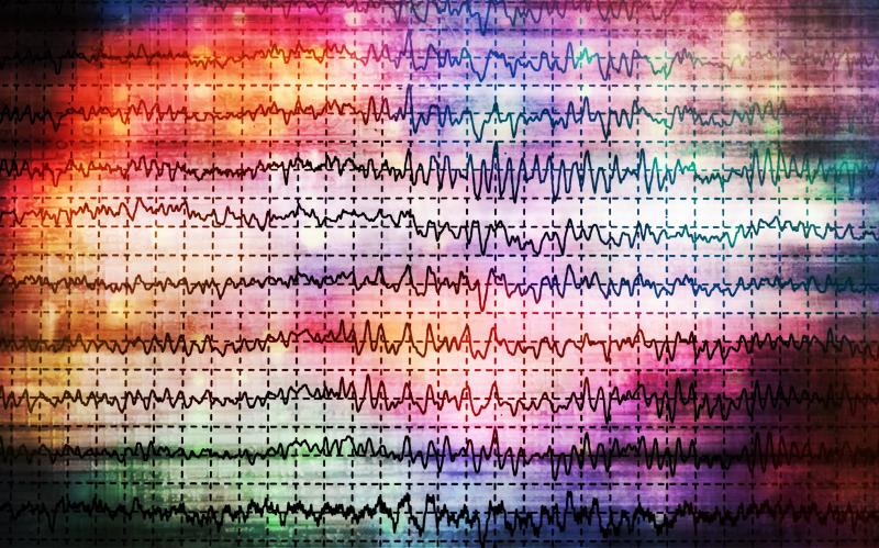 Adjunctive perampanel efficacy, safety in epilepsy hold up over long-term assessment