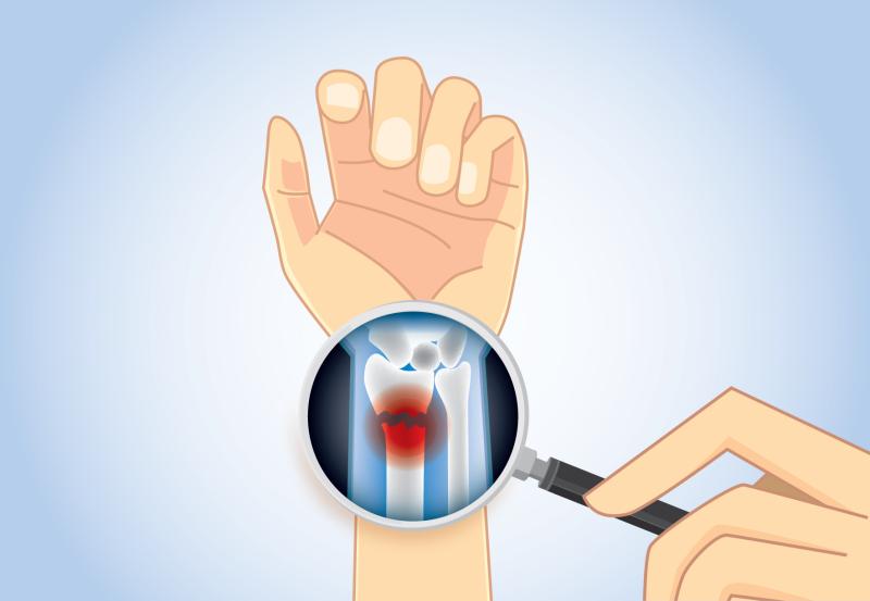 Denosumab tied to higher rates of hyper-, hypocalcaemia in cancer patients with bone metastasis