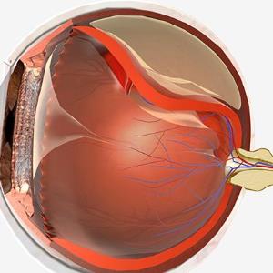 Densiron improves visual outcomes in eyes with primary RRD