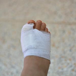 Vitamin D deficiency tied to death risk in diabetic foot ulcer