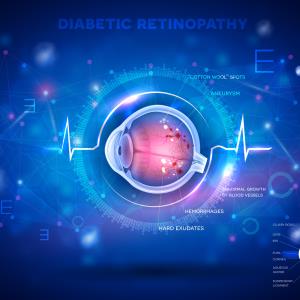 Faricimab vs aflibercept for DME in BCVA 20/50 or worse: Reduced retinal thickness, fewer jabs