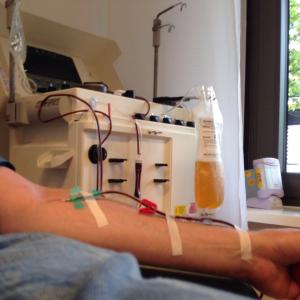 Anticoagulation during CKRT reduces dialysis, death in AKI patients