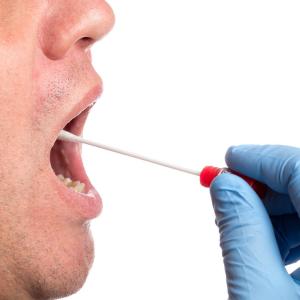 Saliva outperforms nasopharyngeal swabs for COVID-19 detection