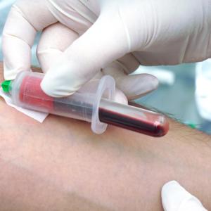 Simple blood test may facilitate diagnosis of Alzheimer’s disease