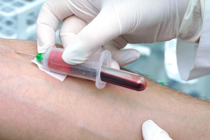 Simple blood test may facilitate diagnosis of Alzheimer’s disease