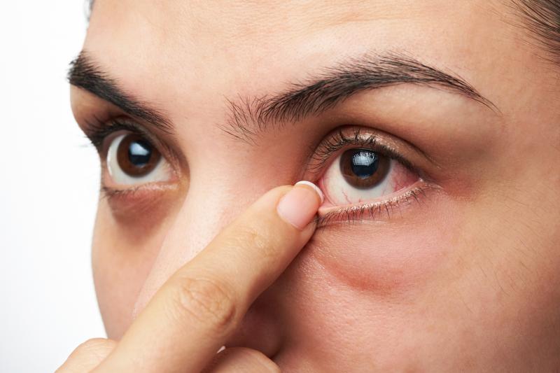Semaglutide linked to modest increase in risk of nonarteritic anterior ischemic optic neuropathy