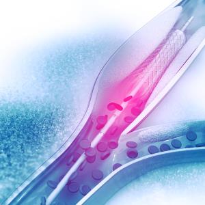 Long-term ACS outcomes similar between TiNO-coated and everolimus-eluting stents