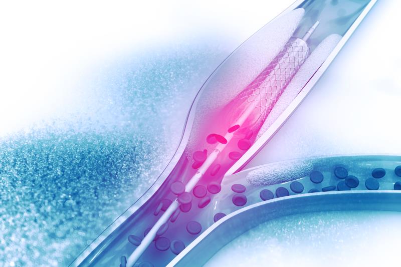 Long-term ACS outcomes similar between TiNO-coated and everolimus-eluting stents