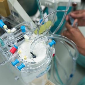 Minimally invasive ECC may play a role in reducing post-cardiac surgery SAEs