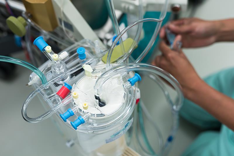 Minimally invasive ECC may play a role in reducing post-cardiac surgery SAEs