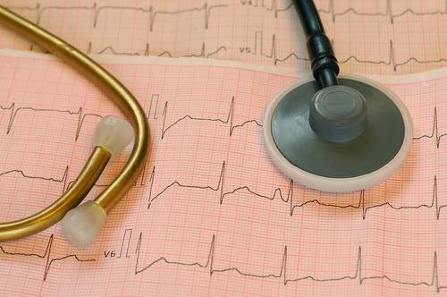 New-onset atrial fibrillation during infection ups 1-year risk of stroke