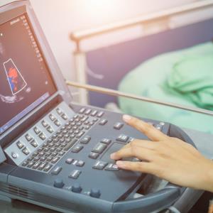 Deep learning-enabled echocardiographic readings help predict CV outcomes