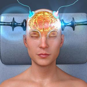 ECT continuation, maintenance may be needed to prevent relapse