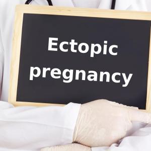 Ectopic pregnancies resolve in around 20 days after methotrexate treatment