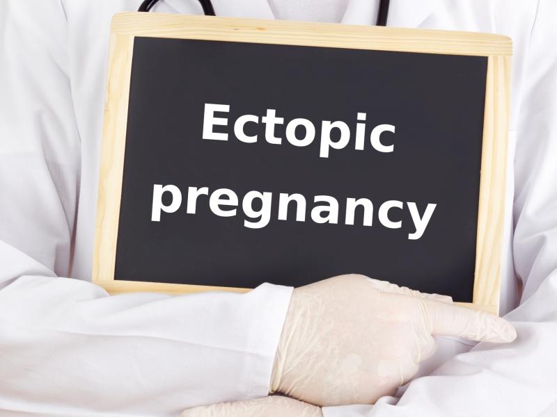 Ectopic pregnancies resolve in around 20 days after methotrexate treatment