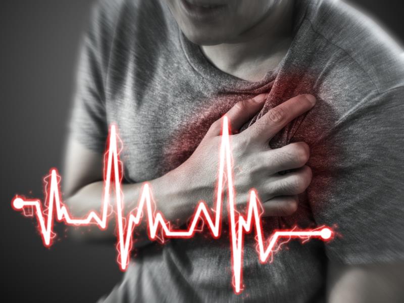 Can we predict sudden cardiac arrests in the general population?