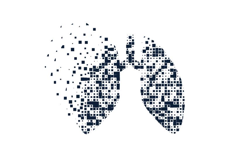 Brigatinib a potential standard treatment alternative for treatment-naive ALK+ NSCLC