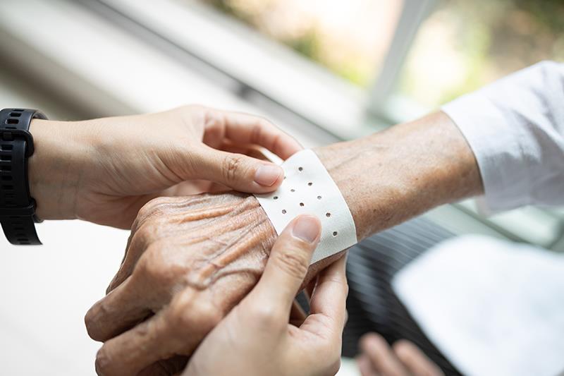 Electrospun fibre patch to simplify psoriasis treatment