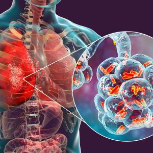 Cardiovascular death among seniors with pneumonia down with antibiotic therapy