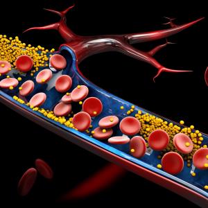 Phase II data reveal treatment potential of pegozafermin for severe hypertriglyceridaemia