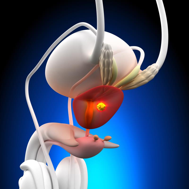 Enzalutamide-ADT extends OS in nmCRPC