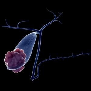 Erlotinib + BSC fares better than BSC alone for gall bladder cancer