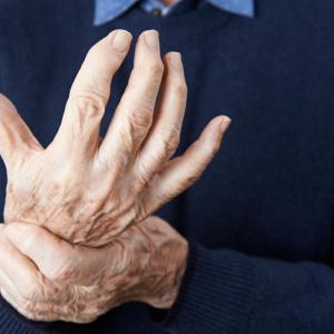 Tocilizumab strikes out in hand osteoarthritis