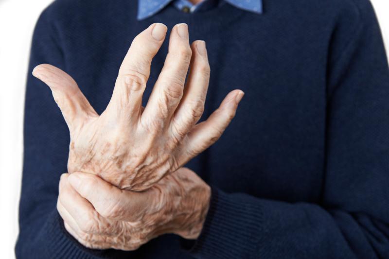 Tocilizumab strikes out in hand osteoarthritis