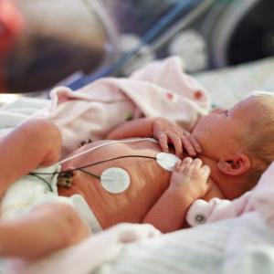 Stethoscope auscultation better than umbilical cord palpitation for measuring newborn heart rate